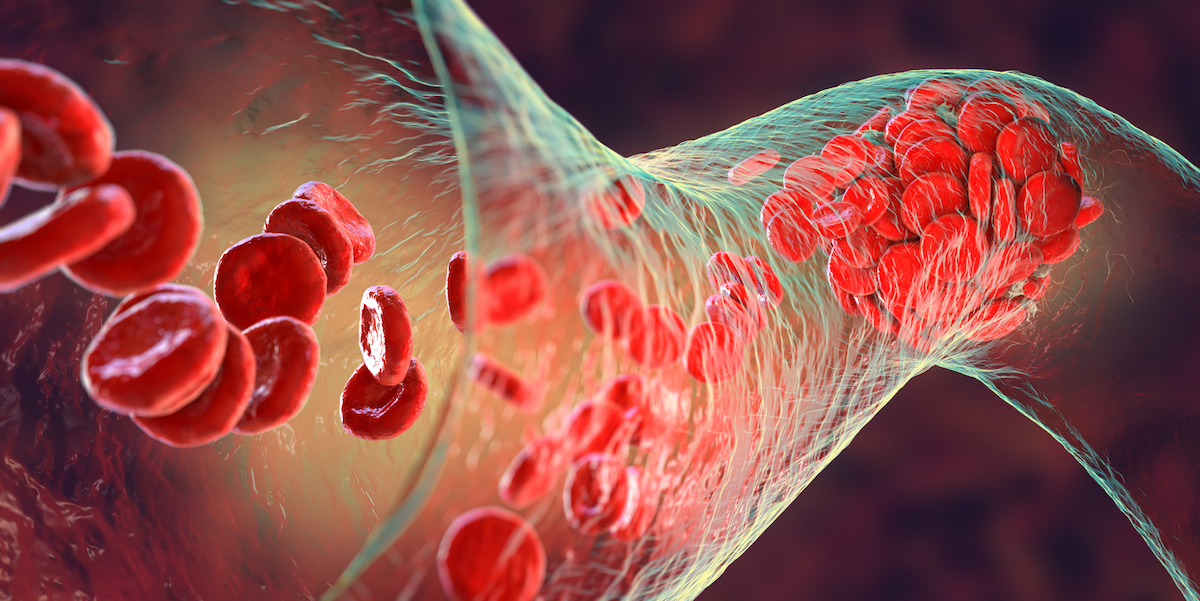 Advances in Coagulation Disorders